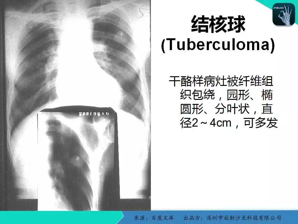 《中华医学影像技术学》数字x线成像技术卷权威的编者团队系统的学科