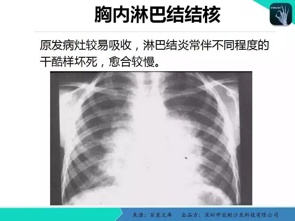 《中华医学影像技术学》数字x线成像技术卷权威的编者团队系统的学科