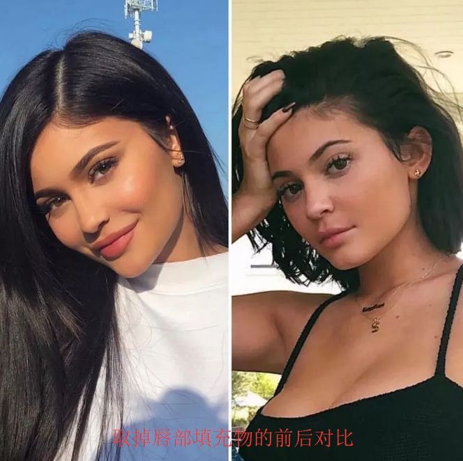 全球最年轻亿万富翁kylie jenner,公开承认整容丰唇