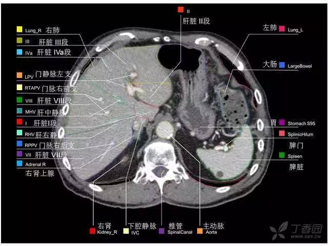 最实用的上腹部 CT 图谱,看过的医生都收藏