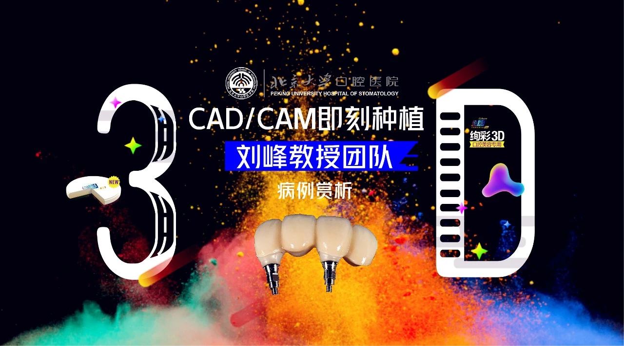 cadcam即刻种植美学区的功能恢复北大口腔刘峰教授团队