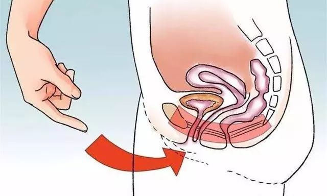 【产后康复·4】唤醒失活的盆底肌