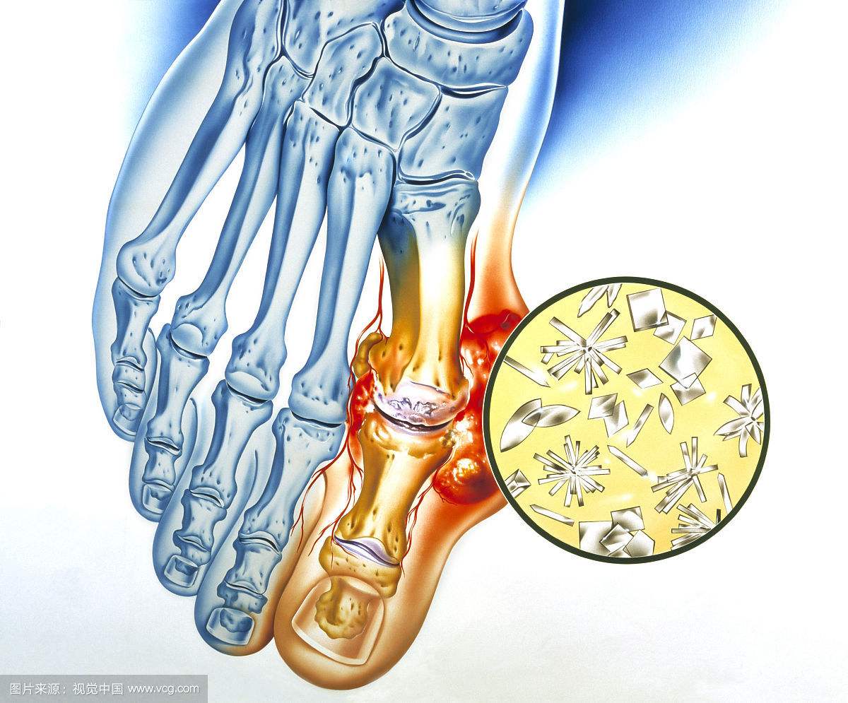 重庆多拉吧生物科技为你讲解_尿酸