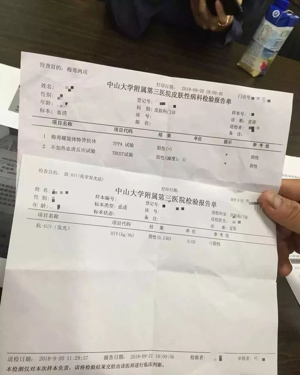 " 保姆l女士的梅毒螺旋体特异抗体为阳性(tppa试验),不加热血清反应