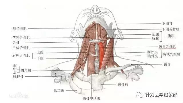 针刀治疗慢性咽炎