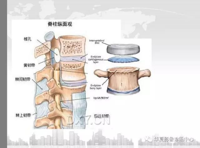 影像基础椎体终板炎怎么看怎么分看完轻松就搞定