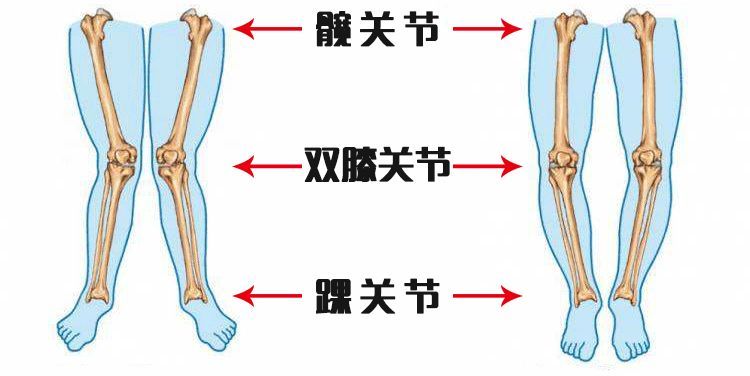 o型,x型腿怎么判断和纠正?