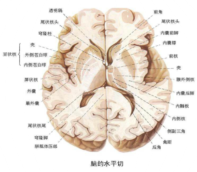 头颅ct解剖与常见出血梗死判读