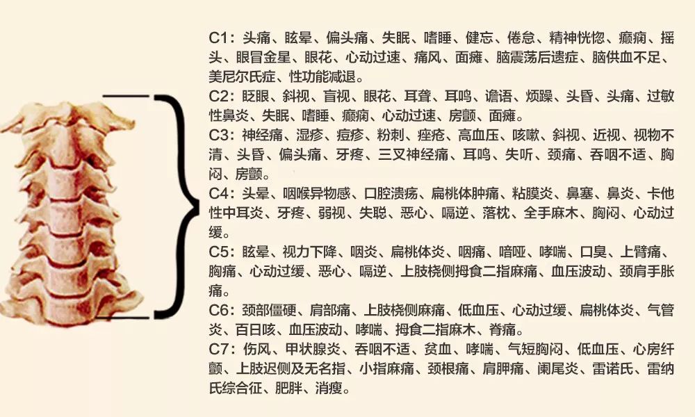 年仅49岁银监会李建华辞世竟是颈椎病导致