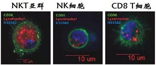 免疫细胞界的姆巴佩--NKT细胞_活化