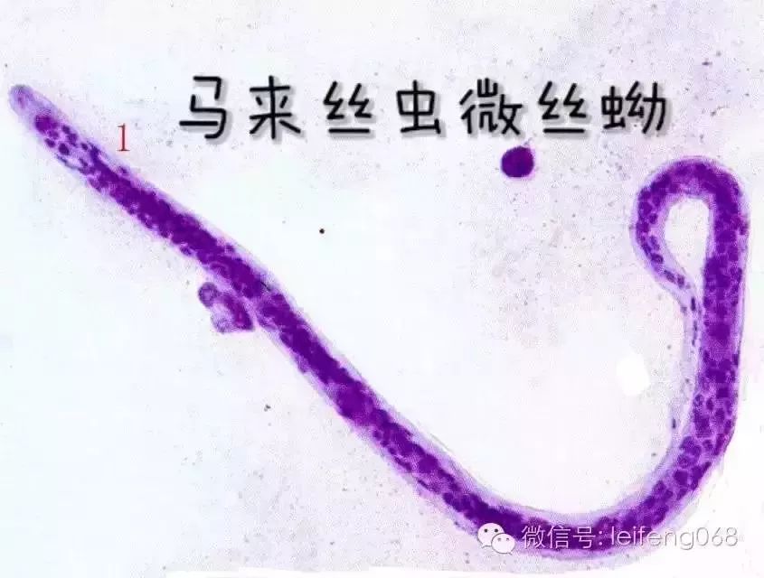 显微镜下的寄生虫原来长这样