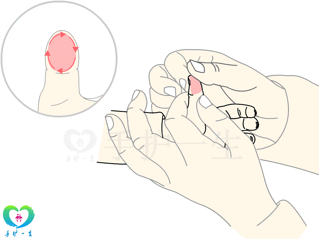 【手法】以拇指指腹在患儿手指螺纹面上顺时针旋转.