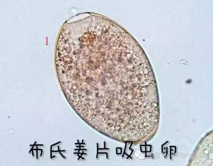 显微镜下的寄生虫原来长这样