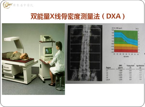 骨密度检查( dxa )