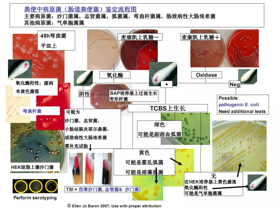 部分细菌的鉴定流程图,值得收藏!