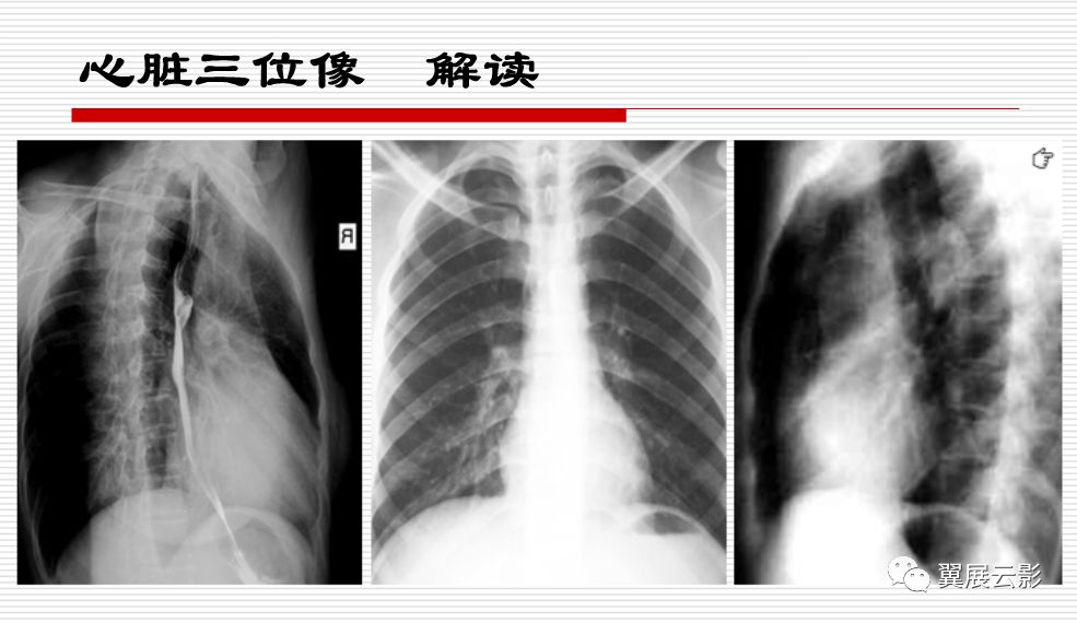 心血管影像学检查解读与合理应用