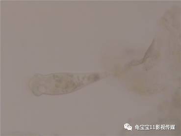 3.镜检结果 1-6号龟腐皮皮屑镜检皆可见密集固着性纤毛虫感染(见图5.