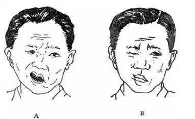 你快救救他,这样的情况都两天了,连喝水都会漏出来,不会是又中风了吧