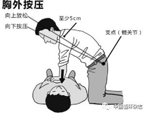 突出"三法" 公众需要掌握使用"三法":即胸外按压cpr,腹部提压cpr