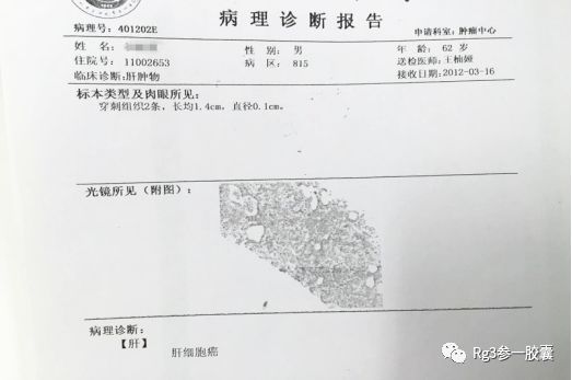 临床研究参一胶囊联合射频消融术治疗多次复发的原发性肝癌一例报告