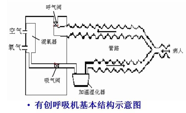 掌握这些,菜鸟也能晋级呼吸机高手丨学呼吸机必备