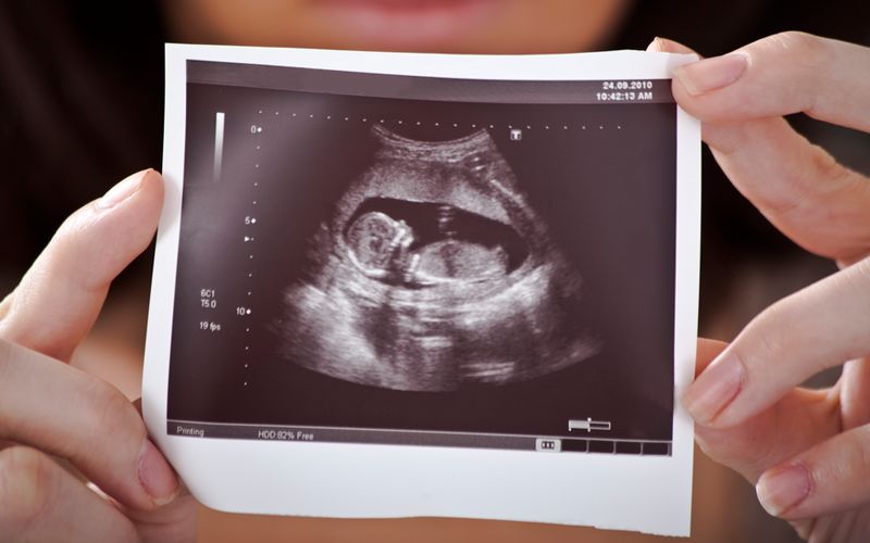怀孕生孩子那些事之为什么用b超对胎儿估重估不准