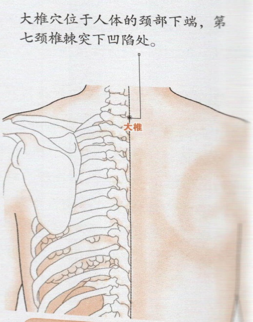 若突起骨不太明显,让患者活动颈部,不动的骨节为第一胸椎,约与肩平齐.