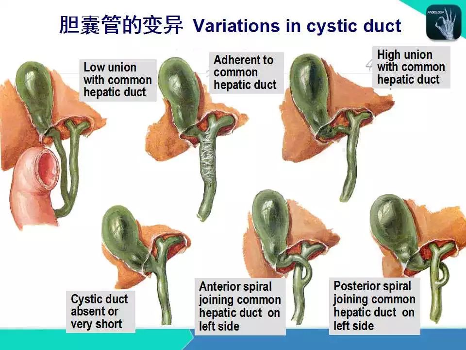 精品课件| 肝胆,门静脉解剖