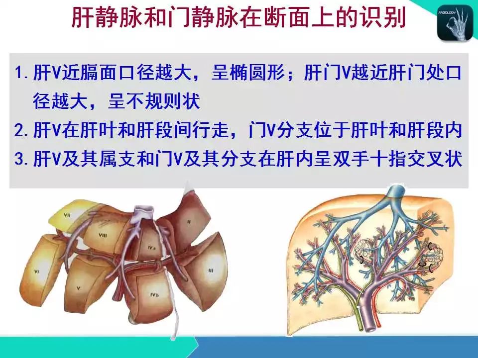 精品课件| 肝胆,门静脉解剖