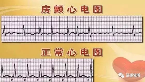 秋冬,一个动作可能会令心脑血管瞬间崩溃,现在知道还不晚