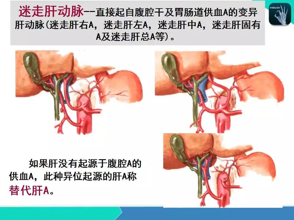 精品课件| 肝胆,门静脉解剖