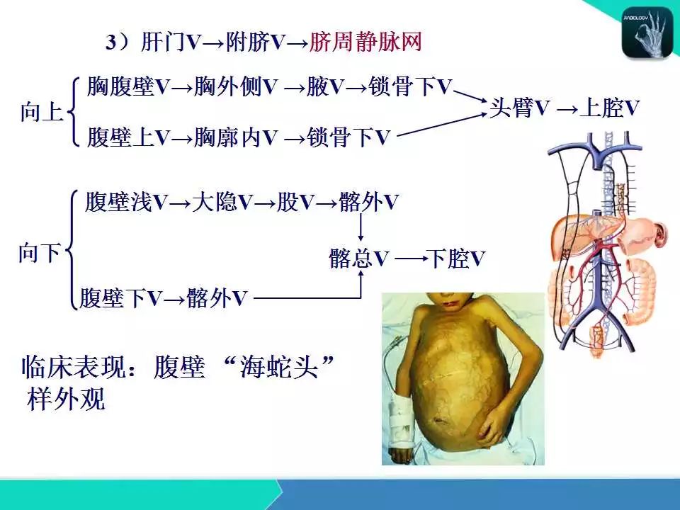 精品课件| 肝胆,门静脉解剖