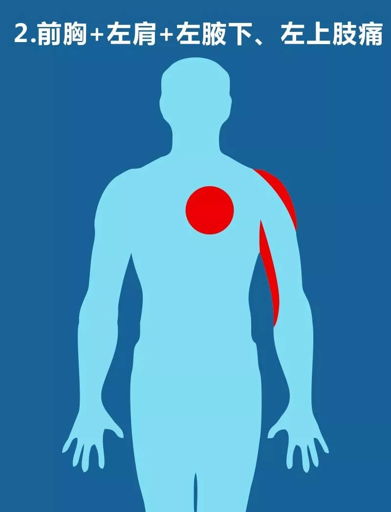 注意这些地方突然疼痛可能心脏出了问题