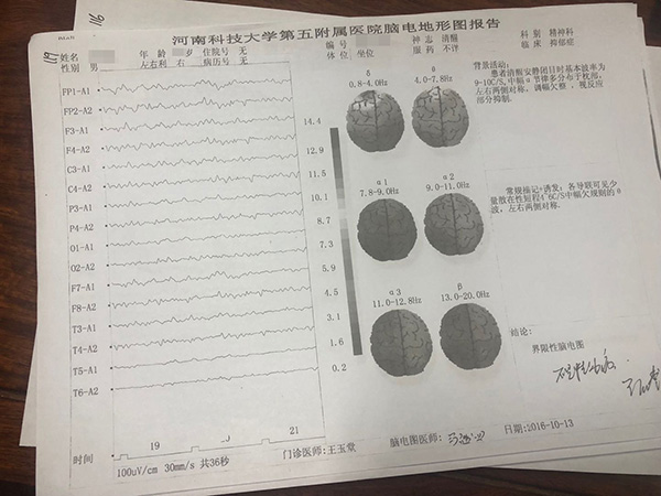 赵阳出院后到其他医院做的脑电地形图报告显示"不是精神病.