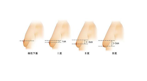 为什么断奶后,乳房会变小,变下垂?究竟元凶是谁?