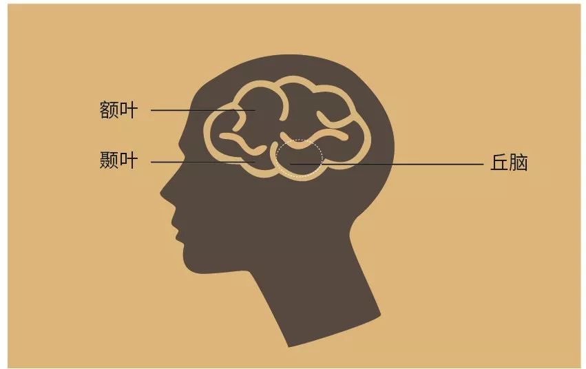 因真实大脑图片难以接受,只好使用类似图片