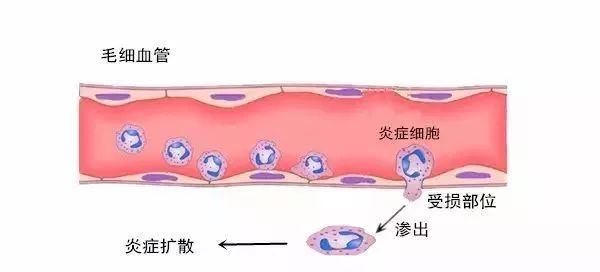 痘痘总是反复长怎么办