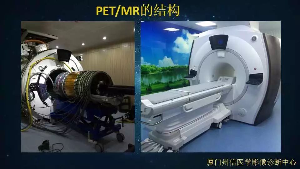 在医院如何做petmr检查一文掌握