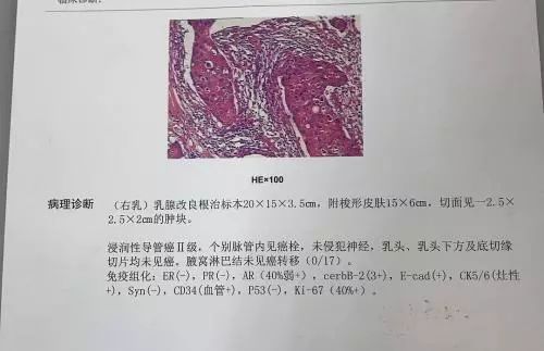 病理报告到底要怎么看