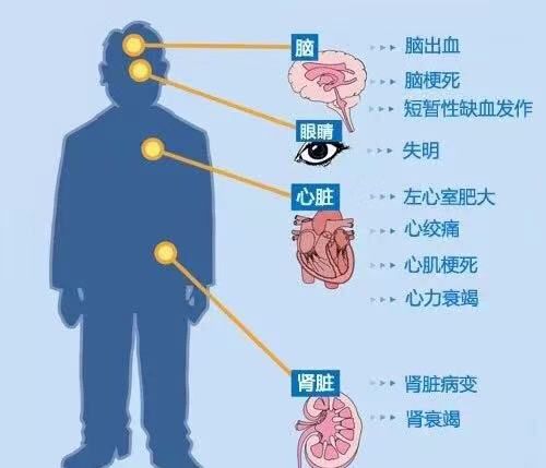 2亿高血压人群,有你吗?