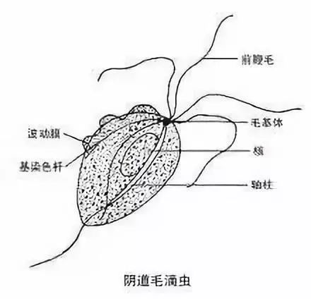 后再引起尿道感染,严重者尿道化脓.进而通过性交,又使男性感染.