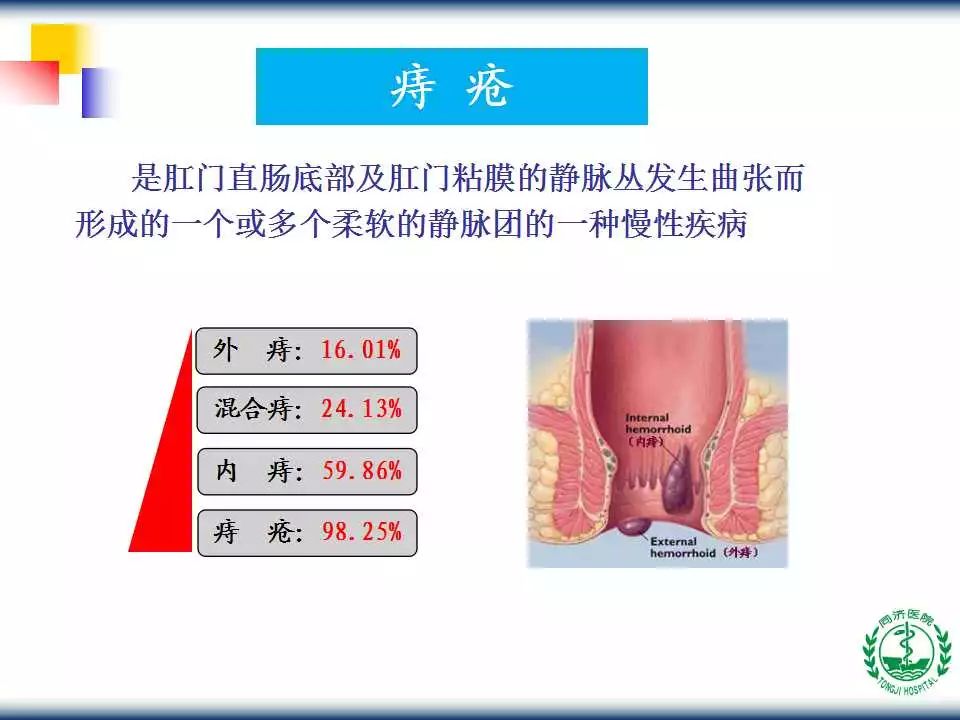 教学ppt | 内镜下内痔硬化治疗术(内含视频,推荐收藏!