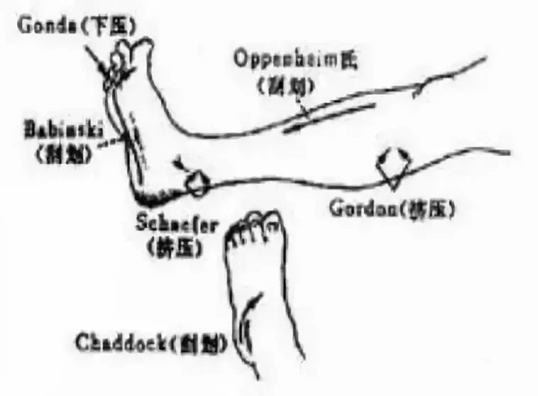 3,口轮匝肌反射4,强握反射自主神经功能检查一,一般检查1,皮肤粘膜2