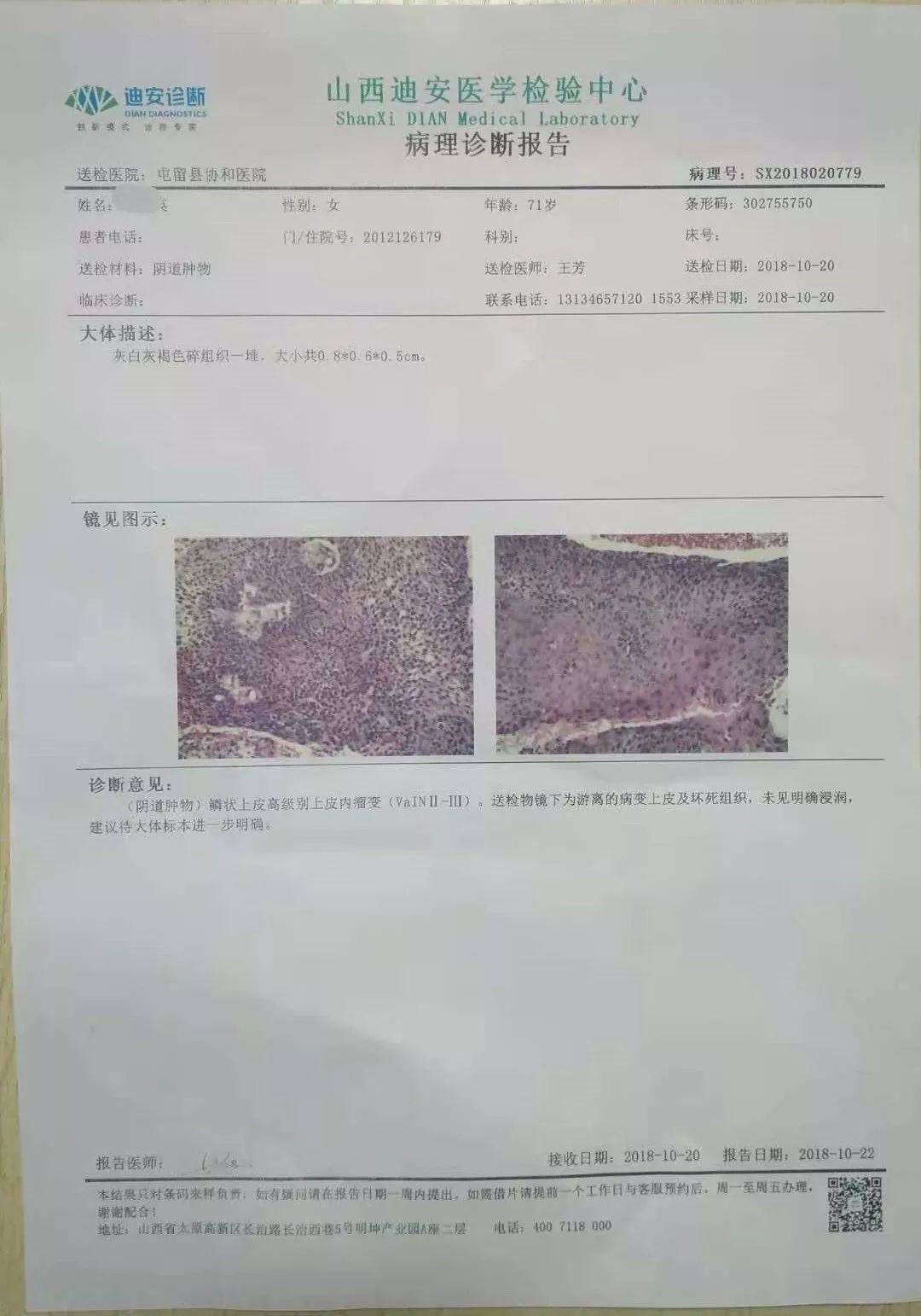 打破高龄手术"禁区",屯留协和医院为71岁阴道癌患者成功实施手术,为妇