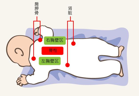 小儿肺炎推荐推拿穴位: 1,平肝清肺5分钟 小儿肺炎是常见病,吴老师