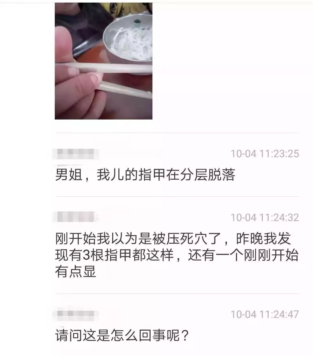 宝宝指甲分层怎么办