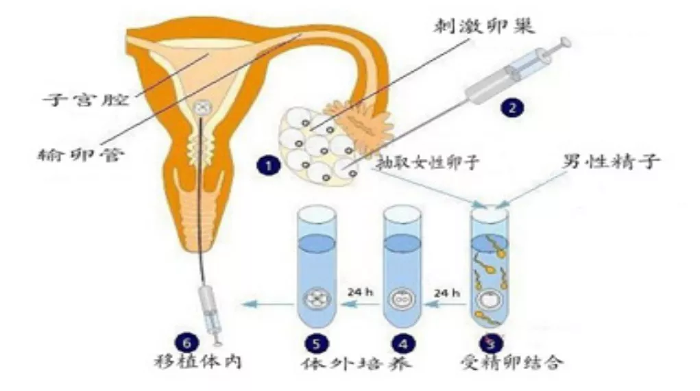 DHEA对于试管备孕的益处有哪些