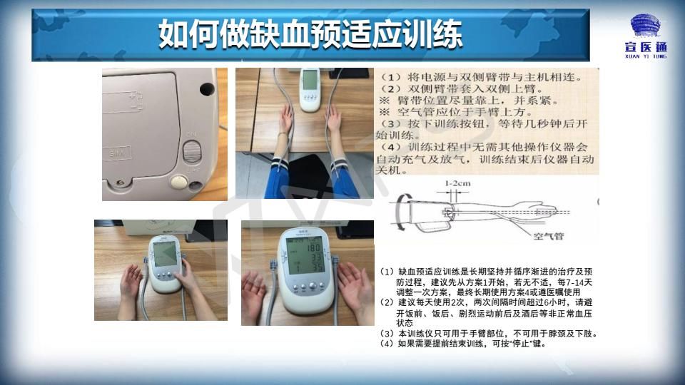 心脑血管病疫苗式疗法大连市友谊医院引入缺血预适应训练