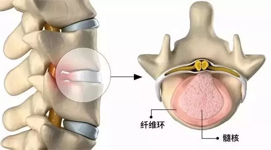 脖子颈椎不好怎么办