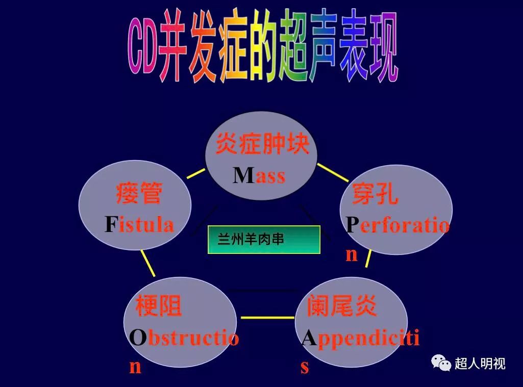 克罗恩病的超声表现和并发症——follow who, 兰州羊肉串